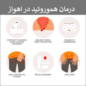 درمان هموروئید بواسیر در اهواز با لیزر در بیمارستان دکتر جراح بواسیر متخصص بواسیر زن خوزستان