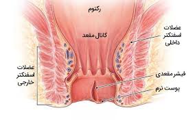بهترین کلینیک درمان شقاق (فیشر) در جنوب تهران