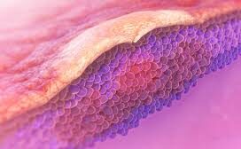 بهترین کلینیک مرکز درمان مولوسکوم غرب تهران | کلینیک ایران مدیکال سنتر