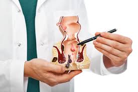 بهترین کلینیک مرکز درمان زگیل تناسلی مقعدی اهواز خوزستان