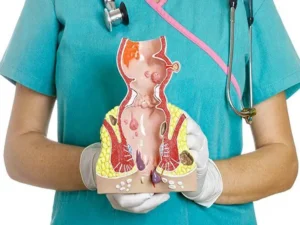 بهترین مرکز کلینیک درمان هموروئید جنوب تهران