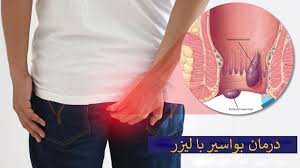 کلینیک مرکز درمان همورویید بواسیر اهواز خوزستان | کلینیک درمان هموروئید اهواز | بهترین کلینیک درمان بواسیر اهواز